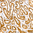 Immunohistochemistry analysis of HuR/ELAVL1 in paraffin-embedded human kidney using [KO Validated] HuR/ELAVL1 Rabbit monoclonal antibody (STJ11101733) at dilution of 1:200 (40x lens). Perform high pressure antigen retrieval with 10 mM citrate buffer pH 6. 0 before commencing with immunohistochemistry staining protocol.