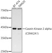 Western blot analysis of various lysates, using Casein Kinase 2 alpha (CSNK2A1) antibody (STJ11101763) at 1:1000 dilution. Secondary antibody: HRP Goat Anti-rabbit IgG (H+L) (STJS000856) at 1:10000 dilution. Lysates/proteins: 25 Mu g per lane. Blocking buffer: 3% non-fat dry milk in TBST. Detection: ECL Basic Kit. Exposure time: 30s.