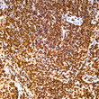 Immunohistochemistry analysis of Ubiquitin in paraffin-embedded mouse spleen tissue using Ubiquitin rabbit monoclonal antibody (STJ11101766) at a dilution of 1:1000 (40x lens). High pressure antigen retrieval was performed with 0. 01 M citrate buffer (pH 6. 0) prior to immunohistochemistry staining.