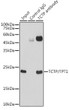 Immunoprecipitation analysis of 300 Mu g extracts of HeLa cells using 3 Mu g TCTP/TPT1 antibody (STJ11101817). Western blot was performed from the immunoprecipitate using TCTP/TPT1 antibody (STJ11101817) at a dilution of 1:1000.