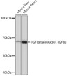 Western blot analysis of various lysates using TGF beta induced TGF beta induced (TGFBI) Rabbit monoclonal antibody (STJ11101820) at 1：1000 dilution. Secondary antibody: HRP Goat Anti-Rabbit IgG (H+L) (STJS000856) at 1:10000 dilution. Lysates/proteins: 25 Mu g per lane. Blocking buffer: 3% nonfat dry milk in TBST. Detection: ECL Basic Kit. Exposure time: 3min.