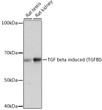 Western blot analysis of various lysates using TGF beta induced TGF beta induced (TGFBI) Rabbit monoclonal antibody (STJ11101820) at 1：1000 dilution. Secondary antibody: HRP Goat Anti-Rabbit IgG (H+L) (STJS000856) at 1:10000 dilution. Lysates/proteins: 25 Mu g per lane. Blocking buffer: 3% nonfat dry milk in TBST. Detection: ECL Basic Kit. Exposure time: 10s.