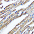 Immunohistochemistry analysis of paraffin-embedded mouse heart using IKK Epsilon rabbit monoclonal antibody (STJ11101875) at dilution of 1:100 (40x lens). Perform microwave antigen retrieval with 10 mM PBS buffer pH 7. 2 before commencing with immunohistochemistry staining protocol.