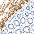 Immunohistochemistry analysis of IKK Epsilon in paraffin-embedded human colon tissue using IKK Epsilon rabbit monoclonal antibody (STJ11101875) at a dilution of 1:200 (40x lens). High pressure antigen retrieval was performed with 0. 01 M citrate buffer (pH 6. 0) prior to immunohistochemistry staining.