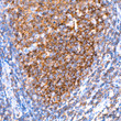 Immunohistochemistry analysis of IKK Epsilon in paraffin-embedded human tonsil tissue using IKK Epsilon rabbit monoclonal antibody (STJ11101875) at a dilution of 1:200 (40x lens). High pressure antigen retrieval was performed with 0. 01 M citrate buffer (pH 6. 0) prior to immunohistochemistry staining.