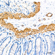Immunohistochemistry analysis of IKK Epsilon in paraffin-embedded rat colon tissue using IKK Epsilon rabbit monoclonal antibody (STJ11101875) at a dilution of 1:200 (40x lens). High pressure antigen retrieval was performed with 0. 01 M citrate buffer (pH 6. 0) prior to immunohistochemistry staining.
