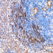 Immunohistochemistry analysis of IKK Epsilon in paraffin-embedded rat spleen tissue using IKK Epsilon rabbit monoclonal antibody (STJ11101875) at a dilution of 1:200 (40x lens). High pressure antigen retrieval was performed with 0. 01 M citrate buffer (pH 6. 0) prior to immunohistochemistry staining.