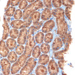 Immunohistochemistry analysis of paraffin-embedded rat kidney using NEK6 Rabbit monoclonal antibody (STJ11101894) at dilution of 1:100 (40x lens). Perform microwave antigen retrieval with 10 mM Tris/EDTA buffer pH 9. 0 before commencing with immunohistochemistry staining protocol.