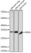 Western blot analysis of extracts of various cell lines, using NEK6 Rabbit monoclonal antibody (STJ11101894) at 1:1000 dilution. Secondary antibody: HRP Goat Anti-Rabbit IgG (H+L) (STJS000856) at 1:10000 dilution. Lysates/proteins: 25 Mu g per lane. Blocking buffer: 3% nonfat dry milk in TBST. Detection: ECL Basic Kit. Exposure time: 3min.