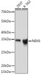 Western blot analysis of extracts of various cell lines, using NEK6 Rabbit monoclonal antibody (STJ11101894) at 1:1000 dilution. Secondary antibody: HRP Goat Anti-Rabbit IgG (H+L) (STJS000856) at 1:10000 dilution. Lysates/proteins: 25 Mu g per lane. Blocking buffer: 3% nonfat dry milk in TBST. Detection: ECL Basic Kit. Exposure time: 1min.