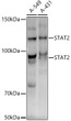 Western blot analysis of extracts of various cell lines, using STAT2 antibody (STJ11101905) at 1:1000 dilution. Secondary antibody: HRP Goat Anti-rabbit IgG (H+L) (STJS000856) at 1:10000 dilution. Lysates/proteins: 25 Mu g per lane. Blocking buffer: 3% non-fat dry milk in TBST. Detection: ECL Basic Kit. Exposure time: 180s.