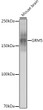 Western blot analysis of extracts of Mouse brain, using GRM5 antibody (STJ11101947) at 1:1000 dilution. Secondary antibody: HRP Goat Anti-Rabbit IgG (H+L) (STJS000856) at 1:10000 dilution. Lysates/proteins: 25 Mu g per lane. Blocking buffer: 3% nonfat dry milk in TBST. Detection: ECL Basic Kit. Exposure time: 30s.