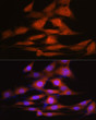 Immunofluorescence analysis of NIH-3T3 cells using LXR Alpha Rabbit monoclonal antibody (STJ11101976) at dilution of 1:100 (40x lens). Secondary antibody: Cy3 Goat Anti-Rabbit IgG (H+L) at 1:500 dilution. Blue: DAPI for nuclear staining.