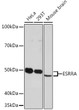 Western blot analysis of extracts of various cell lines, using ESRRA Rabbit monoclonal antibody (STJ11102011) at 1:1000 dilution. Secondary antibody: HRP Goat Anti-Rabbit IgG (H+L) (STJS000856) at 1:10000 dilution. Lysates/proteins: 25 Mu g per lane. Blocking buffer: 3% nonfat dry milk in TBST. Detection: ECL Enhanced Kit. Exposure time: 3min.