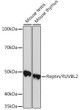 Western blot analysis of extracts of various cell lines, using Reptin/RUVBL2 Rabbit monoclonal antibody (STJ11102022) at 1:1000 dilution. Secondary antibody: HRP Goat Anti-Rabbit IgG (H+L) (STJS000856) at 1:10000 dilution. Lysates/proteins: 25 Mu g per lane. Blocking buffer: 3% nonfat dry milk in TBST. Detection: ECL Basic Kit. Exposure time: 90s.