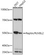 Western blot analysis of extracts of various cell lines, using Reptin/RUVBL2 Rabbit monoclonal antibody (STJ11102022) at 1:1000 dilution. Secondary antibody: HRP Goat Anti-Rabbit IgG (H+L) (STJS000856) at 1:10000 dilution. Lysates/proteins: 25 Mu g per lane. Blocking buffer: 3% nonfat dry milk in TBST. Detection: ECL Basic Kit. Exposure time: 3s.
