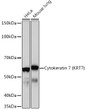Western blot analysis of extracts of various cell lines, using Cytokeratin 7 (KRT7) (KRT7) rabbit monoclonal antibody (STJ11102055) at 1:1000 dilution. Secondary antibody: HRP Goat Anti-rabbit IgG (H+L) (STJS000856) at 1:10000 dilution. Lysates/proteins: 25 Mu g per lane. Blocking buffer: 3% non-fat dry milk in TBST. Detection: ECL Basic Kit. Exposure time: 10s.