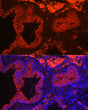 Immunofluorescence analysis of Rat lung using KRT7 antibody (STJ11102055) at dilution of 1:50 (40x lens). Blue: DAPI for nuclear staining.
