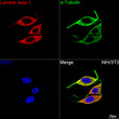 Confocal imaging of NIH/3T3 cells using Laminin beta 1 Rabbit monoclonal antibody (STJ11102059, dilution 1:200) followed by a further incubation with Cy3 Goat Anti-Rabbit IgG (H+L) ( dilution 1:500) (Red). The cells were counterstained with Alpha-Tubulin Mouse monoclonal antibody ( dilution 1:400) followed by incubation with ABflo® 488-conjugated Goat Anti-Mouse IgG (H+L) antibody ( dilution 1:500) (Green). DAPI was used for nuclear staining (Blue). Objective: 100x.