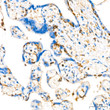 Immunohistochemistry analysis of paraffin-embedded human placenta using Stathmin 1 rabbit monoclonal antibody (STJ11102063) at dilution of 1:200 (40x lens). Perform high pressure antigen retrieval with 10 mM citrate buffer pH 6. 0 before commencing with immunohistochemistry staining protocol.