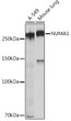 Western blot analysis of extracts of various cell lines, using NUMA11 rabbit monoclonal antibody (STJ11102077) at 1:1000 dilution. Secondary antibody: HRP Goat Anti-rabbit IgG (H+L) (STJS000856) at 1:10000 dilution. Lysates/proteins: 25 Mu g per lane. Blocking buffer: 3% non-fat dry milk in TBST. Detection: ECL Basic Kit. Exposure time: 10s.