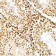 Immunohistochemistry analysis of NUMA1 in paraffin-embedded mouse testis tissue using NUMA1 rabbit monoclonal antibody (STJ11102077) at a dilution of 1:200 (40x lens). High pressure antigen retrieval was performed with 0. 01 M citrate buffer (pH 6. 0) prior to immunohistochemistry staining.