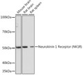 Western blot analysis of extracts of various cell lines, using Neurokinin 1 Receptor (NK1R) (NK1R) Rabbit monoclonal antibody (STJ11102127) at 1:1000 dilution. Secondary antibody: HRP Goat Anti-Rabbit IgG (H+L) (STJS000856) at 1:10000 dilution. Lysates/proteins: 25 Mu g per lane. Blocking buffer: 3% nonfat dry milk in TBST. Detection: ECL Basic Kit. Exposure time: 10s.