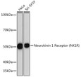 Western blot analysis of extracts of various cell lines, using Neurokinin 1 Receptor (NK1R) (NK1R) Rabbit monoclonal antibody (STJ11102127) at 1:1000 dilution. Secondary antibody: HRP Goat Anti-Rabbit IgG (H+L) (STJS000856) at 1:10000 dilution. Lysates/proteins: 25 Mu g per lane. Blocking buffer: 3% nonfat dry milk in TBST. Detection: ECL Basic Kit. Exposure time: 3s.