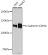 Western blot analysis of extracts of various cell lines, using K-Cadherin (CDH6) Rabbit monoclonal antibody (STJ11102130) at 1:3000 dilution. Secondary antibody: HRP Goat Anti-Rabbit IgG (H+L) (STJS000856) at 1:10000 dilution. Lysates/proteins: 25 Mu g per lane. Blocking buffer: 3% nonfat dry milk in TBST. Detection: ECL Basic Kit. Exposure time: 10s.