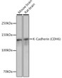 Western blot analysis of extracts of various cell lines, using K-Cadherin (CDH6) Rabbit monoclonal antibody (STJ11102130) at 1:3000 dilution. Secondary antibody: HRP Goat Anti-Rabbit IgG (H+L) (STJS000856) at 1:10000 dilution. Lysates/proteins: 25 Mu g per lane. Blocking buffer: 3% nonfat dry milk in TBST. Detection: ECL Basic Kit. Exposure time: 1s.