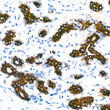 Immunohistochemistry analysis of paraffin-embedded human breast using Cytokeratin 7 (KRT7) rabbit monoclonal antibody (STJ11102150) at dilution of 1:200 (40x lens). Perform high pressure antigen retrieval with 10 mM citrate buffer pH 6. 0 before commencing with immunohistochemistry staining protocol.