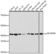 Western blot analysis of extracts of various cell lines, using p38 MAPK rabbit monoclonal antibody (STJ11102152) at 1:1000 dilution. Secondary antibody: HRP Goat Anti-rabbit IgG (H+L) (STJS000856) at 1:10000 dilution. Lysates/proteins: 25 Mu g per lane. Blocking buffer: 3% non-fat dry milk in TBST. Detection: ECL Basic Kit. Exposure time: 1min.