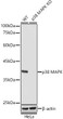 Western blot analysis of extracts from wild type (WT) and p38 MAPK knockout (KO) HeLa cells, using p38 MAPK antibody (STJ11102152) at 1:1000 dilution. Secondary antibody: HRP Goat Anti-rabbit IgG (H+L) (STJS000856) at 1:10000 dilution. Lysates/proteins: 25 Mu g per lane. Blocking buffer: 3% non-fat dry milk in TBST. Detection: ECL Basic Kit. Exposure time: 3s.