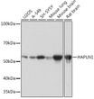 Western blot analysis of extracts of various cell lines, using HAPLN1 Rabbit monoclonal antibody (STJ11102159) at 1:1000 dilution. Secondary antibody: HRP Goat Anti-Rabbit IgG (H+L) (STJS000856) at 1:10000 dilution. Lysates/proteins: 25 Mu g per lane. Blocking buffer: 3% nonfat dry milk in TBST. Detection: ECL Basic Kit. Exposure time: 1s.