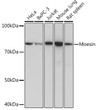 Western blot analysis of extracts of various cell lines, using Moesin Rabbit monoclonal antibody (STJ11102196) at 1:1000 dilution. Secondary antibody: HRP Goat Anti-Rabbit IgG (H+L) (STJS000856) at 1:10000 dilution. Lysates/proteins: 25 Mu g per lane. Blocking buffer: 3% nonfat dry milk in TBST. Detection: ECL Basic Kit. Exposure time: 1s.