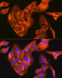 Immunofluorescence analysis of U-2 OS cells using JNK1/JNK3 Rabbit monoclonal antibody (STJ11102232) at dilution of 1:100 (40x lens). Secondary antibody: Cy3 Goat Anti-Rabbit IgG (H+L) at 1:500 dilution. Blue: DAPI for nuclear staining.