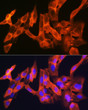Immunofluorescence analysis of C6 cells using JNK1/JNK3 Rabbit monoclonal antibody (STJ11102232) at dilution of 1:100 (40x lens). Secondary antibody: Cy3 Goat Anti-Rabbit IgG (H+L) at 1:500 dilution. Blue: DAPI for nuclear staining.
