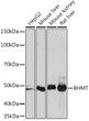 Western blot analysis of extracts of various cell lines, using BHMT Rabbit monoclonal antibody (STJ11102269) at 1:1000 dilution. Secondary antibody: HRP Goat Anti-Rabbit IgG (H+L) (STJS000856) at 1:10000 dilution. Lysates/proteins: 25 Mu g per lane. Blocking buffer: 3% nonfat dry milk in TBST. Detection: ECL Basic Kit. Exposure time: 180S.