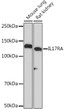 Western blot analysis of extracts of various cell lines, using IL17RA Rabbit monoclonal antibody (STJ11102278) at 1:1000 dilution. Secondary antibody: HRP Goat Anti-Rabbit IgG (H+L) (STJS000856) at 1:10000 dilution. Lysates/proteins: 25 Mu g per lane. Blocking buffer: 3% nonfat dry milk in TBST. Detection: ECL Basic Kit. Exposure time: 10s.