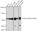 Western blot analysis of extracts of various cell lines, using RUVBL1/TIP49A/PONTIN rabbit monoclonal antibody (STJ11102285) at 1:1000 dilution. Secondary antibody: HRP Goat Anti-rabbit IgG (H+L) (STJS000856) at 1:10000 dilution. Lysates/proteins: 25 Mu g per lane. Blocking buffer: 3% non-fat dry milk in TBST. Detection: ECL Basic Kit. Exposure time: 3min.