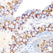 Immunohistochemistry analysis of paraffin-embedded mouse testis using RUVBL1/TIP49A/PONTIN rabbit monoclonal antibody (STJ11102285) at dilution of 1:100 (40x lens). Perform microwave antigen retrieval with 10 mM Tris/EDTA buffer pH 9. 0 before commencing with immunohistochemistry staining protocol.