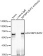 Immunoprecipitation analysis of 300 Mu g extracts of HepG2 cells using 3 Mu g IGF2BP2/IMP2 antibody (STJ11102288). Western blot was performed from the immunoprecipitate using IGF2BP2/IMP2 antibody (STJ11102288) at a dilution of 1:1000.