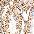 Immunohistochemistry analysis of DDX17 in paraffin-embedded mouse testis tissue using DDX17 rabbit monoclonal antibody (STJ11102313) at a dilution of 1:200 (40x lens). High pressure antigen retrieval was performed with 0. 01 M Tris-EDTA buffer (pH 9. 0) prior to immunohistochemistry staining.