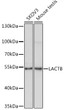 Western blot analysis of various lysates using LACTB Rabbit polyclonal antibody (STJ11102333) at 1:1000 dilution. Secondary antibody: HRP Goat Anti-Rabbit IgG (H+L) (STJS000856) at 1:10000 dilution. Lysates/proteins: 25 Mu g per lane. Blocking buffer: 3% nonfat dry milk in TBST. Detection: ECL Basic Kit. Exposure time: 1s.