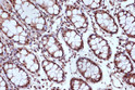 Immunohistochemistry analysis of paraffin-embedded Human colon using MSH2 Rabbit mAb (STJ11102365) at dilution of 1:100 (40x lens). Microwave antigen retrieval performed with 0. 01M Tris/EDTA Buffer (pH 9. 0) prior to immunohistochemistry staining.