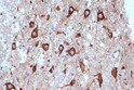 Immunohistochemistry analysis of paraffin-embedded Human brain tissue using PRKRA/PACT Rabbit mAb  (STJ11102374) at a dilution of 1:400 (40x lens).  High pressure antigen retrieval was performed with 0. 01 M citrate buffer (pH 6. 0) prior to immunohistochemistry staining.