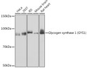 Western blot analysis of various lysates using Glycogen synthase 1 (Glycogen synthase 1 (GYS1) ) Rabbit mAb (STJ11102394) at 1:1000 dilution. <br/>Secondary antibody: HRP-conjugated Goat anti-Rabbit IgG (H+L) (STJS000856) at 1:10000 dilution. <br/>Lysates/proteins: 25 Mu g per lane. <br/>Blocking buffer: 3% nonfat dry milk in TBST. <br/>Detection: ECL Basic Kit <br/>Exposure time: 30s.