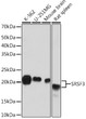 Western blot analysis of various lysates using SRSF3 Rabbit mAb (STJ11102415) at 1:1000 dilution. <br/>Secondary antibody: HRP-conjugated Goat anti-Rabbit IgG (H+L) (STJS000856) at 1:10000 dilution. <br/>Lysates/proteins: 25 Mu g per lane. <br/>Blocking buffer: 3% nonfat dry milk in TBST. <br/>Detection: ECL Basic Kit <br/>Exposure time: 10s.