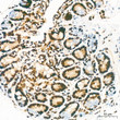 Immunohistochemistry analysis of paraffin-embedded Human thyroid tissue using KHSRP Rabbit mAb (STJ11102419) at a dilution of 1:200 (40x lens). High pressure antigen retrieval performed with 0. 01M Citrate Bufferr (pH 6. 0) prior to immunohistochemistry staining.