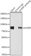 Western blot analysis of various lysates using KHSRP Rabbit mAb (STJ11102419) at 1:1000 dilution. <br>Secondary antibody: HRP Goat Anti-Rabbit IgG (H+L) (STJS000856) at 1:10000 dilution. <br>Lysates/proteins: 25 Mu g per lane. <br>Blocking buffer: 3% nonfat dry milk in TBST. <br>Detection: ECL Basic Kit <br>Exposure time: 10s.
